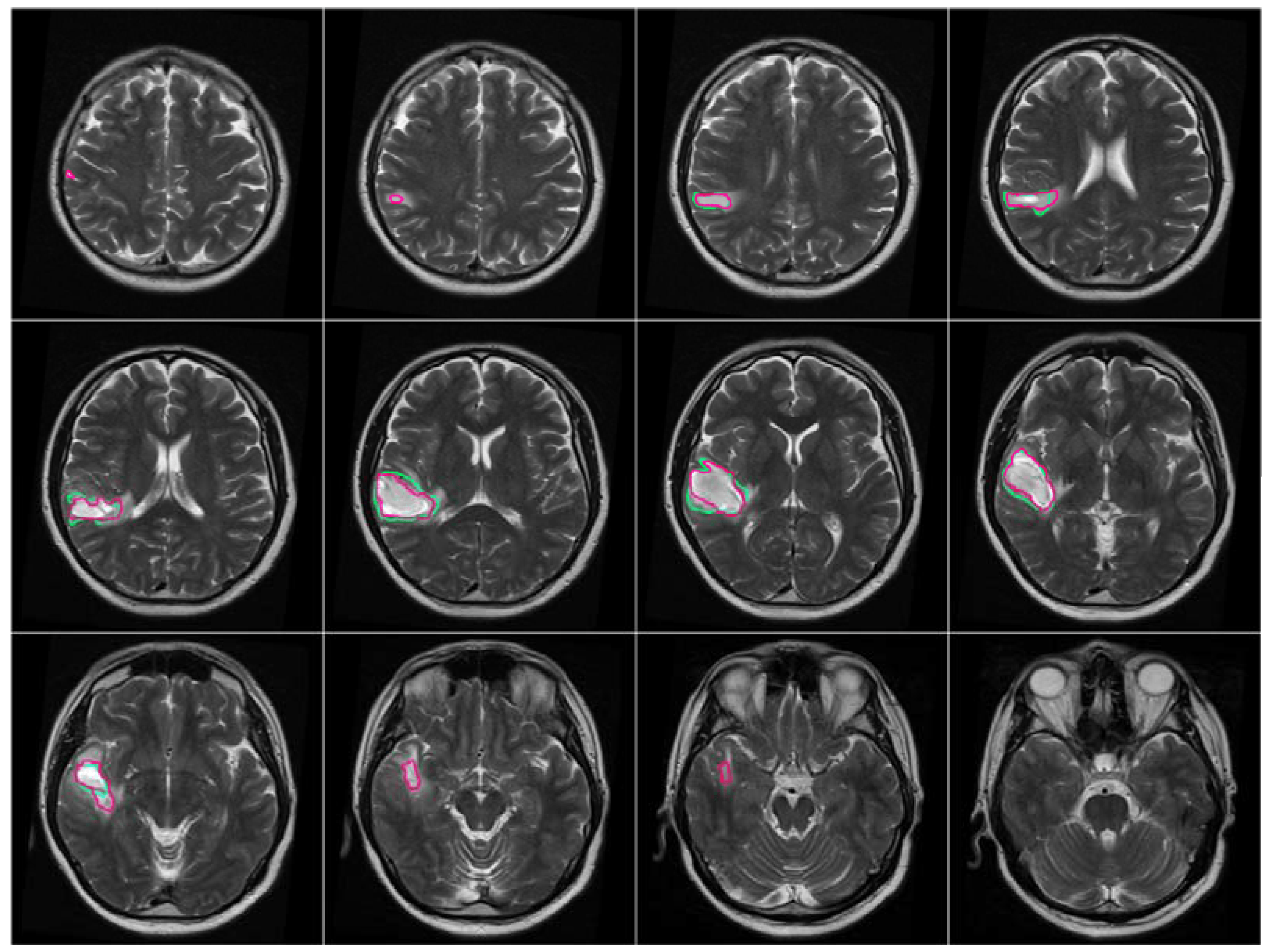 MRI Wallpapers 4k HD MRI Backgrounds On WallpaperBat